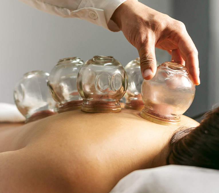 HERO-BANNER.CUPPING-THERAPHY-MOBILE